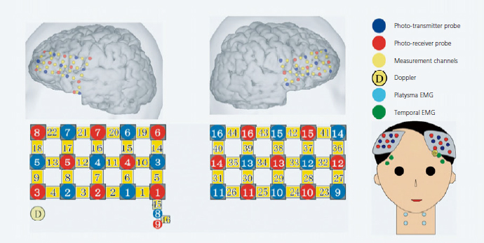 Fig. 1  Multiresolution Analysis