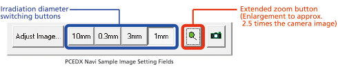 Automatic Four-Stage Switching Between 0.3, 1, 3, and 10 mm in Diameter